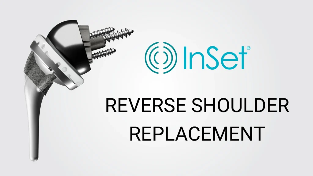 InSet® branded reverse shoulder replacement technology. 